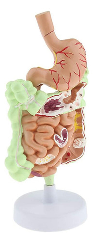 Modelo De Sistema Digestivo Humano De Tamaño Natural, Anatom