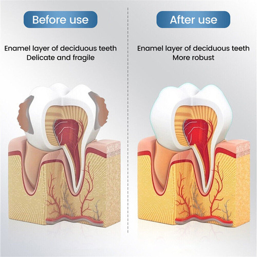 - Pasta De Dientes De Reparación Rápida For Caries 120 G*2