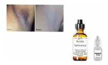 Comprar Clareador (clareador Corporal Axilas E Virilhas) 20ml