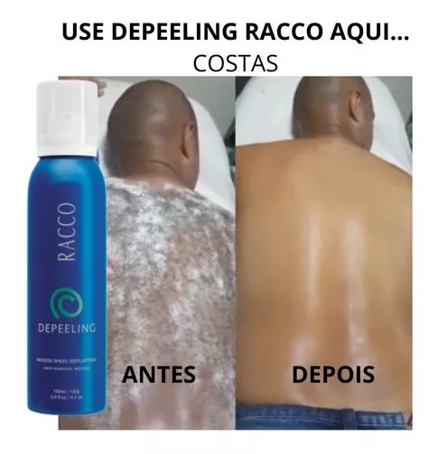 Terceira imagem para pesquisa de spray depilatorio