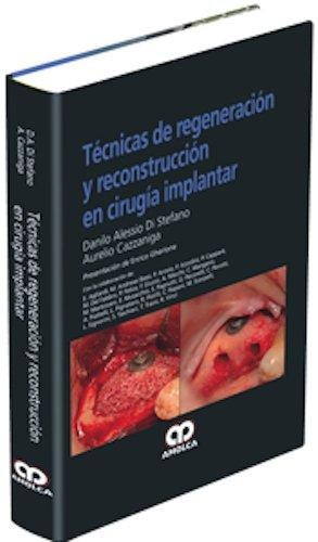 Técnicas De Regeneración-reconstrucción En Cirugía Implantar