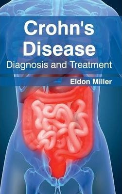 Libro Crohn's Disease - Eldon Miller