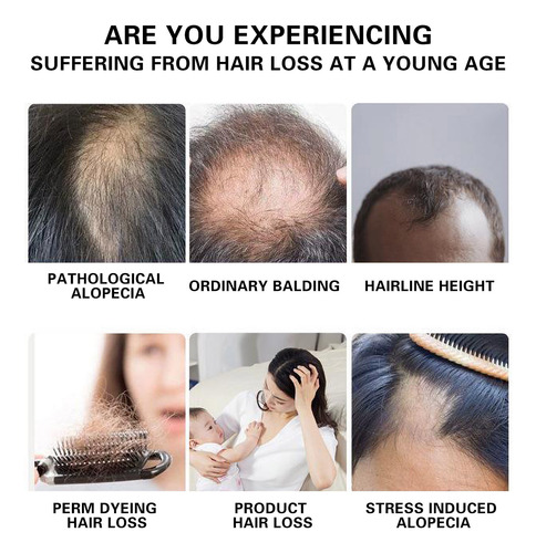 Shampoo Deixando Seu Cabelo Mais Cheio De 240 Ml Com AparĂȘnc