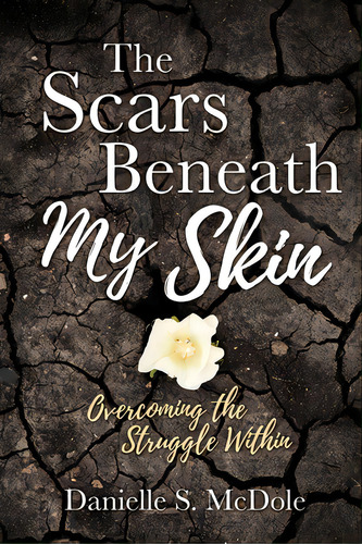 The Scars Beneath My Skin: Overcoming The Struggle Within, De Mcdole, Danielle S.. Editorial Xulon Pr, Tapa Blanda En Inglés