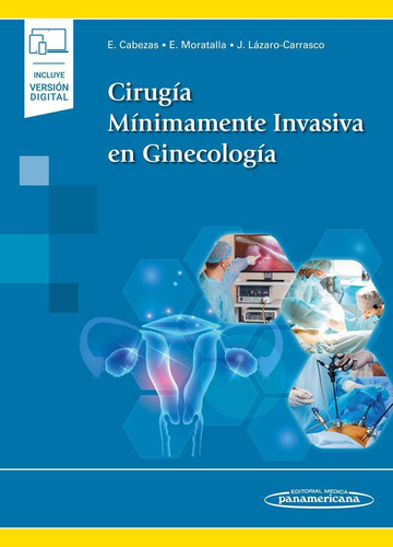 Cirugia Minimante Invasiva En Ginecologia - Cabezas 