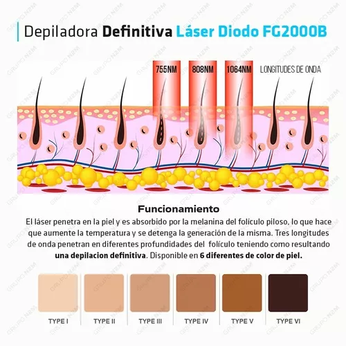 Maquina Depilacion Definitiva Laser Diodo Adss Profesional