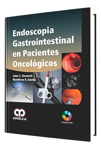 Endoscopia Gastrointestinal En Pacientes Oncológicos. Amolca