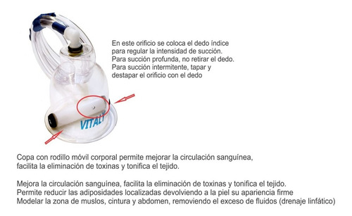 Imagen 3 de 3 de Vacumterapia Vitaly Nano Con 1 Copa De 6 Cm Con Rodillo