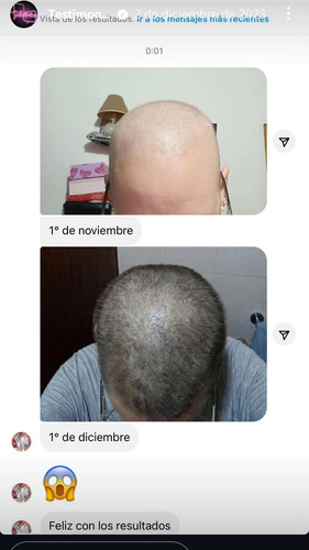 Shampoo Y Acondicionador Tratamiento Anticaida
