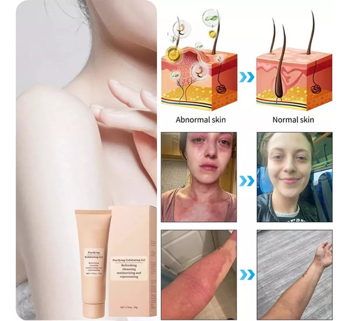 Gel Exfoliante Purificante Jorondy De 2 Piezas, Exfoliante,