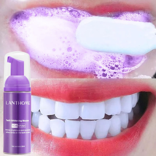 Imagen 5 de 9 de Kit De Blanqueamiento Dental Blanc Oral Care De 4 Unidades