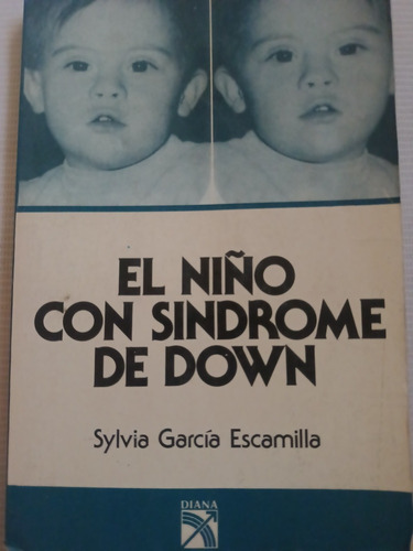 El Niño Con Síndrome De Down Sylvia García Escalona 