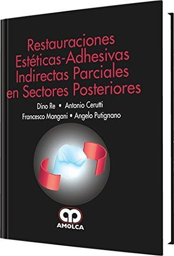 Restauraciones Estéticas-adhesivas Indirectas Parciales Post