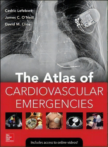 Atlas Of Cardiovascular Emergencies, De Cedric Lefebvre. Editorial Mcgraw-hill Education - Europe En Inglés