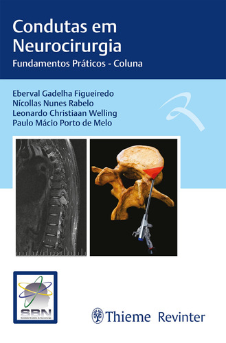 Condutas em Neurocirurgia: Fundamentos Práticos - Coluna, de Gadelha Figueiredo, Eberval. Editora Thieme Revinter Publicações Ltda, capa mole em português, 2022