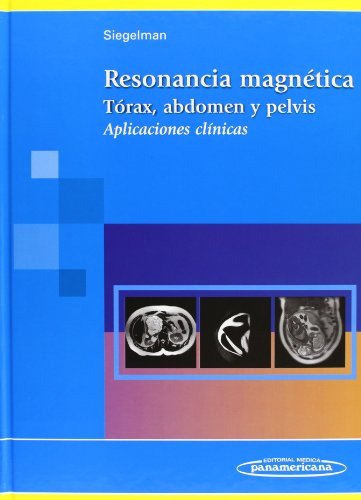 Libro Resonancia Magnetica Torax Abdomen Y Pelvis Aplicacion