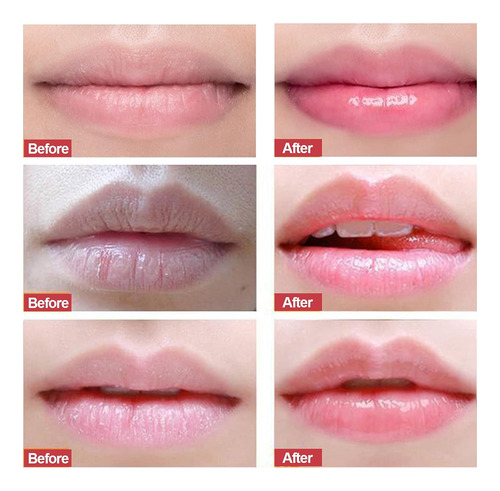 Exfoliante De Labios, Exfoliante De Matorrales De Labios Y H