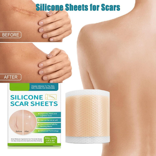 . Láminas De Silicona Profesionales For Cicatrices