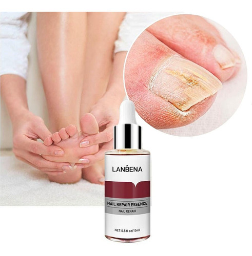 Set 2pz Lanbena Esencia Reparadora Uñas Y Removedor Uñas