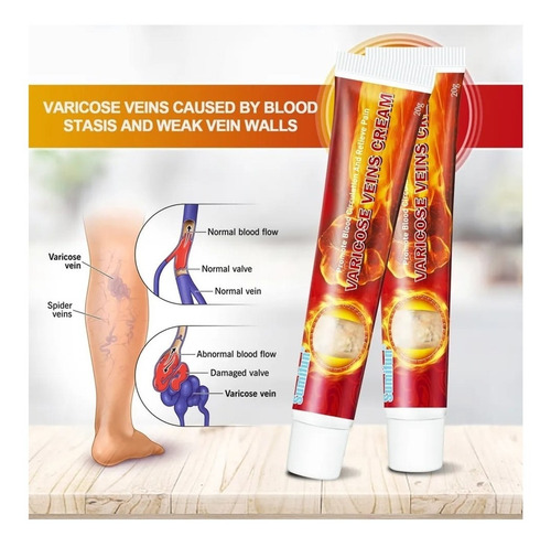Sumifun - 2 Cremas Para Flebitis, Venas Varicosas, Varices