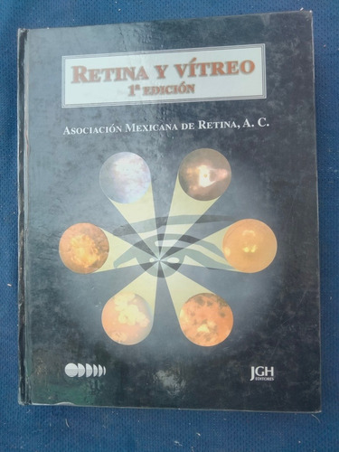 Retina Y Vítreo      1a Edición 