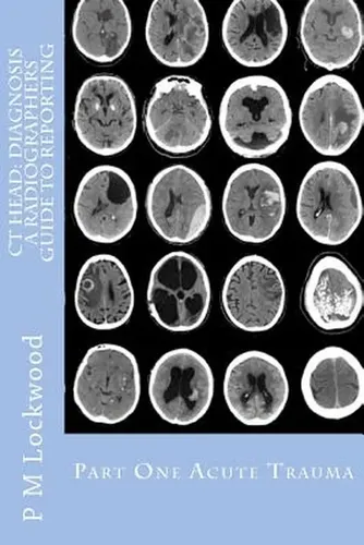 Head Ct Notes.pdf Ct Head: Diagnosis A Radiographers Guide To Reporting Part 1 | Cuotas ...