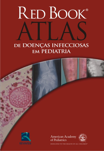 Red Book Atlas de Doenças Infecciosas em Pediatria, de Baker, Carol J.. Editorial Thieme Revinter Publicações Ltda, capa dura em português, 2015