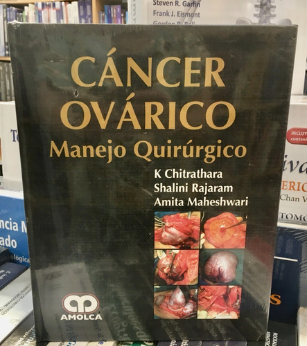 Cáncer Ovárico Manejo Quirúrgico