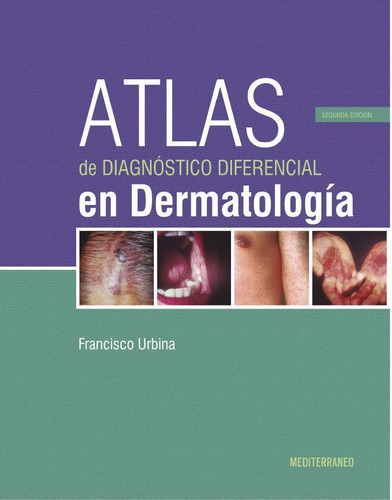 Atlas De Diagnostico Diferencial En Dermatologia - Urbina