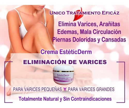 Sin Varices Arañitas Dolores Piernas Edemas Venillas