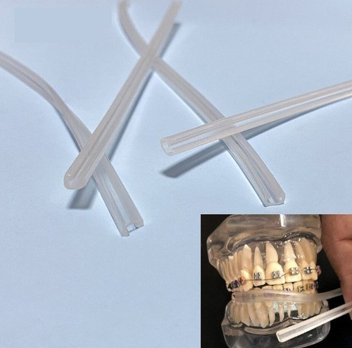 Imagen 3 de 9 de Protección Para Ortodoncia Bracket Protege Labios Y Mejillas