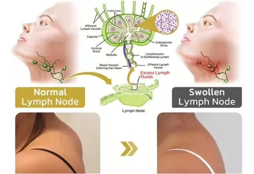 Pendientes De Germanio Lymphvity De Halolux, Para 4 Unidades