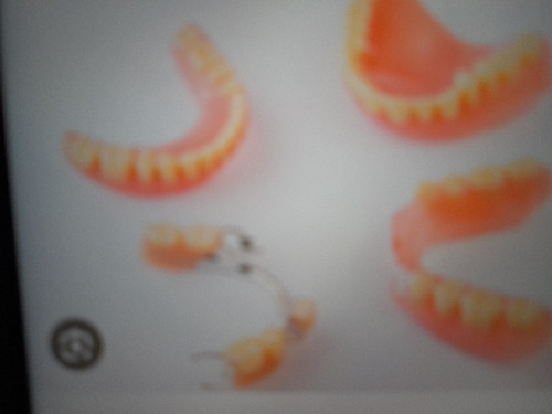Mecanico Dental Directo Arreglo De Protesis Rotas