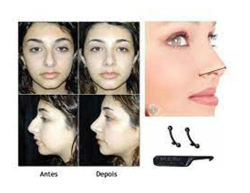 Imagen 6 de 8 de Repingador Protesis Correctora Nariz Nose Up 3 Medidas