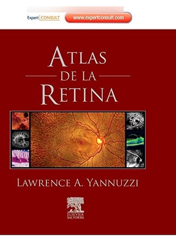 Libro Atlas De La Retina De Lawrence A. Yannuzzi Elsevier Es