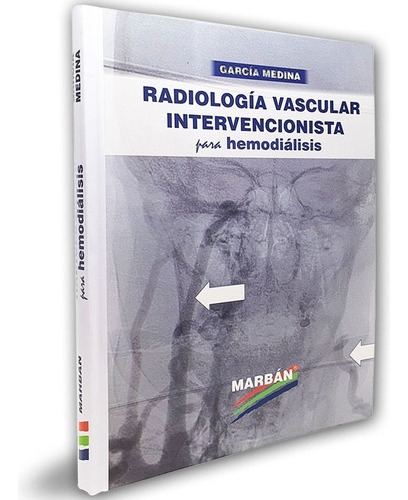 Radiología Vascular Intervencionista Para Hemodiálisis: No Aplica, De Garcia Medina. Serie No Aplica, Vol. No Aplica. Editorial Marban, Tapa Dura, Edición 1 En Español, 2021