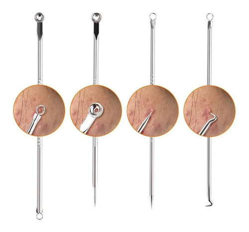 Imagem 4 de 8 de Extrator Removedor Cravo Espinha Kit 4 Agulhas Aço Inox
