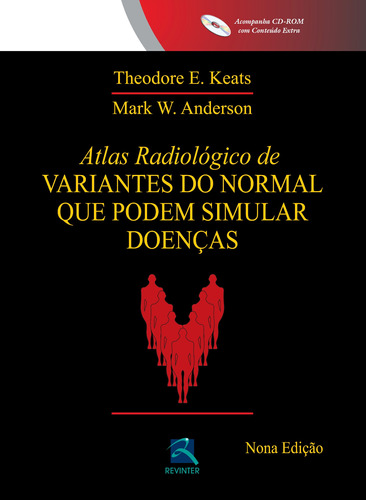 Atlas Radiológico de Variantes do Normal que podem Simular Doenças, de Keats, Theodore E.. Editora Thieme Revinter Publicações Ltda, capa dura em português, 2015