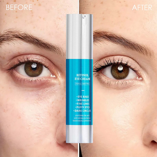 W Retinol Eye Cream Serume 20ml For Hydrating Moisturiz 6001