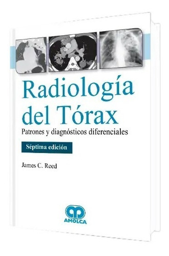 Radiología Del Tórax Patrones Y Diagnósticos Diferenc. 7 Ed