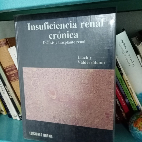 Insuficiencia Renal Crónica Diálisis Y Trasplante Renal