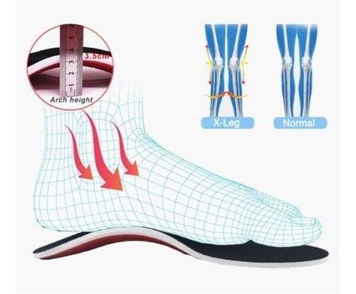 Imagen 6 de 10 de Plantillas Ortopedicas Ajustables Para Fascitis - Unisex