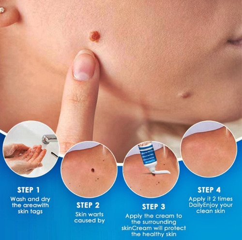 5 Peças De Creme De Remoção Instantânea De Manchas Removedor