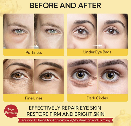 Parches Para Ojos De Retinol Antiedad.ácido Hialurónico