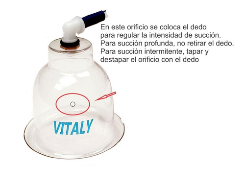 Imagen 2 de 2 de Campana / Copa De Vacumterapia 6 Cm Sin Rodillo Vitaly