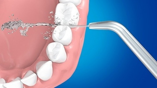 Irrigador Dental Limpieza Bucal Blanco H2ofloss Pórtatil.