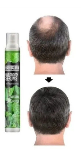 Tónico Herbal Crecer Cabello - mL a $4000