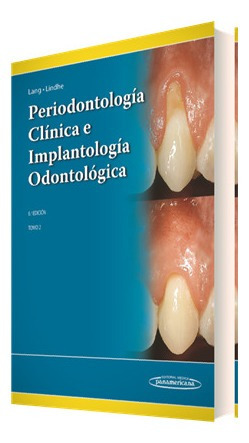 Periodontología Clínica E Implantología Odontológica. Tomo 2