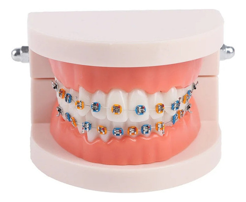 Colorido Aparatos Dentales Falsosdecoración Dental Temporal