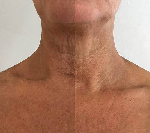My Instant Effects Neck And Chest Rejuvenating Serum For Wom